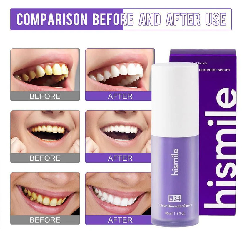 Teeth Whitening Serum