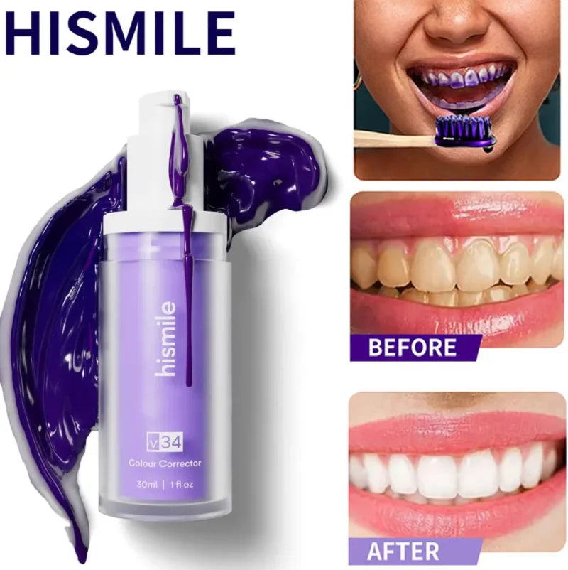 Teeth Whitening Serum